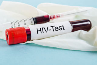 Dzięki technologii mRNA jest szansa na stworzenie szczepionki przeciw HIV