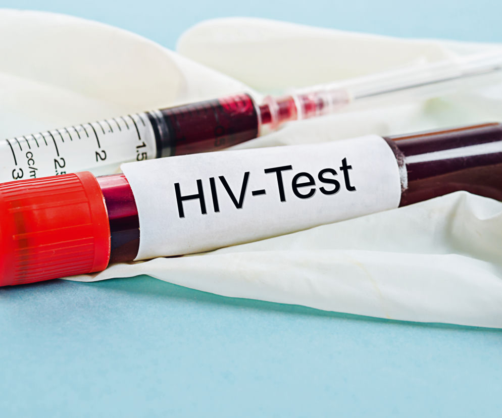 test na HIV ampuiłka
