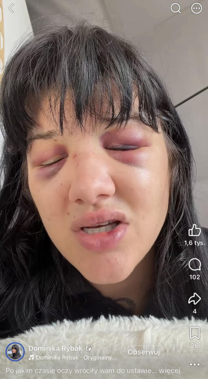 Dominika Rybak po walce