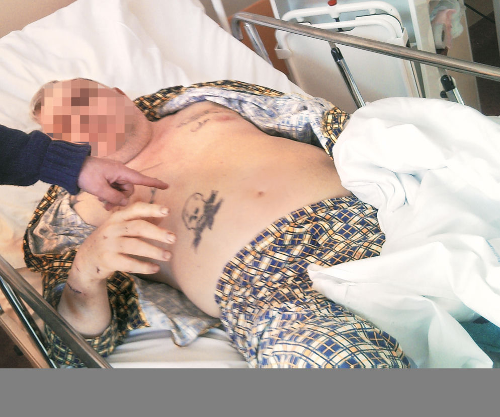 Ksiądz pobił się 17-letnim z masażystą