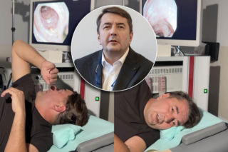 Chirurg pokazał swoją kolonoskopię w sieci. Profesor zdradził powód