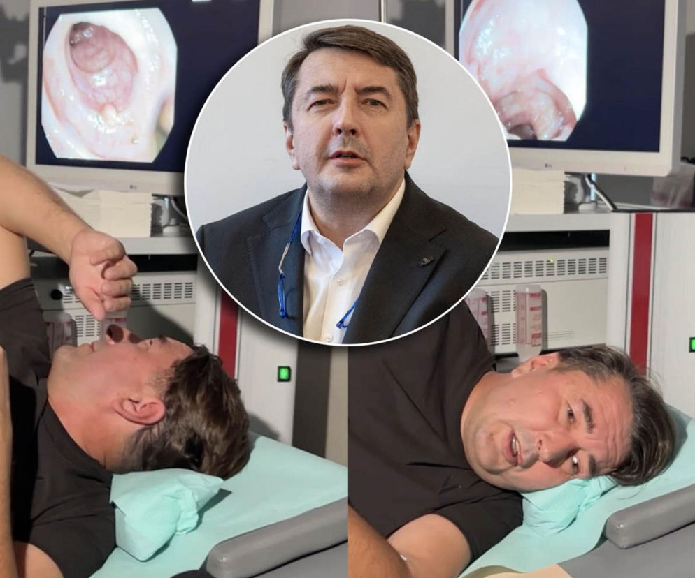 Lekarz zrobił sobie kolonoskopię na żywo