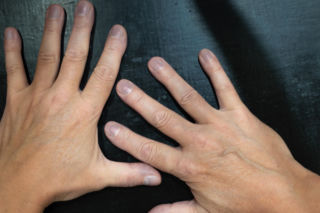 Złącz dwa palce i sprawdź, czy widzisz okienko. Ten banalny test może uratować ci życie