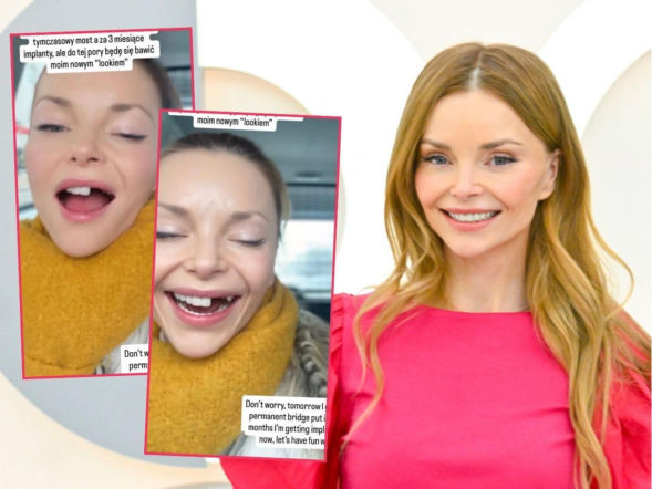 Iza Miko świeci szczerbatym uśmiechem! Przesadziła z treningami do Tańca z Gwiazdami?