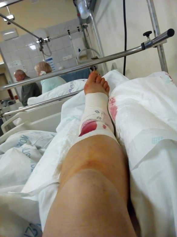 Spadła z kombajnu i ŚWIAT RUNĄŁ