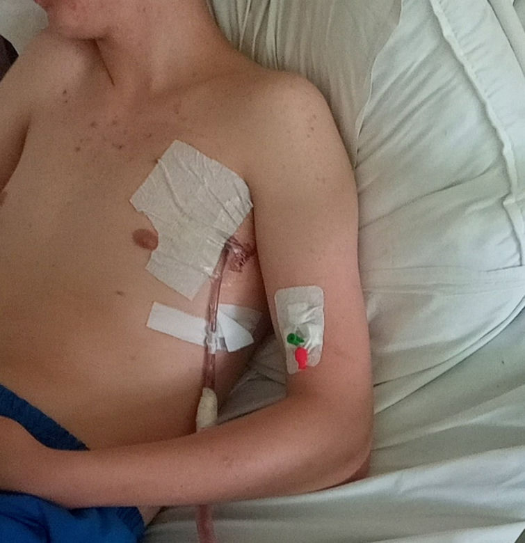 Ostrze noża minęło serce Kacpra o dwa centymetry. Zaatakował go 12-letni chłopiec