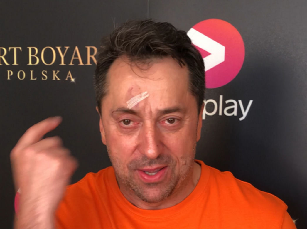Marcin Miller oberwał w czoło