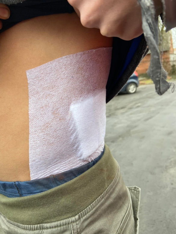 Nazwał koleżankę "su**". W ruch poszły noże. Kulisy krwawej jatki pod Ostrowem