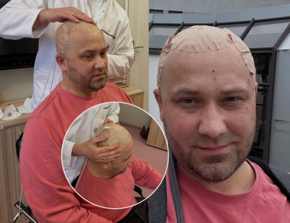 Adrian ze Ślubu... pokazał zdjęcia z terapii. Chce działać, aby nikt nie musiał wybierać między życiem a pieniędzmi