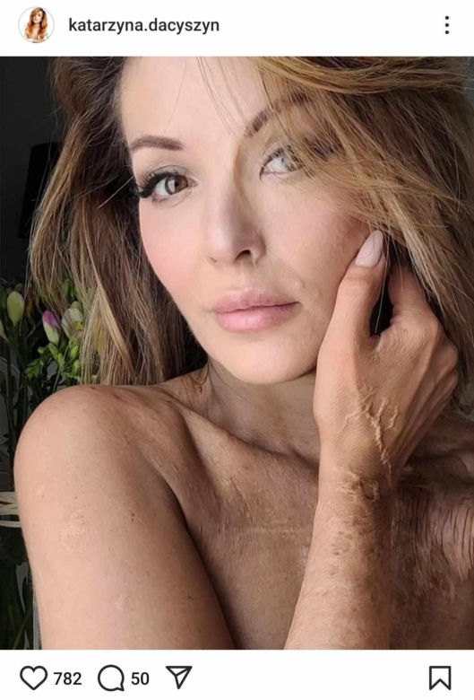 Katarzyna Dacyszyn
