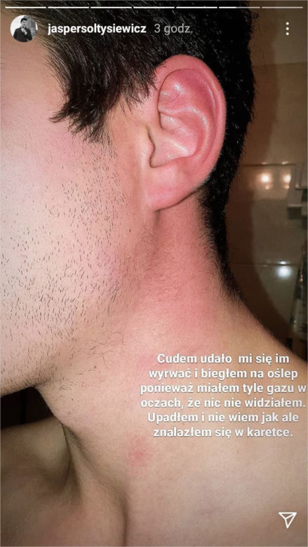 Gwiazdror "Barw szczęścia" oskarża policję o brutalne pobicie