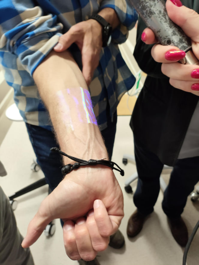 Teraz znalezienie żył u dzieci nie będzie problemem. Szpital dostał specjalne skanery