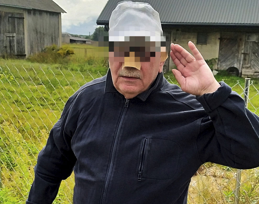 Krwawa przygoda gospodarza z Mazowsza. Krowa Baśka zjadła mu nos