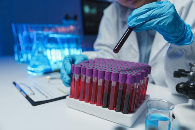 Nowotwory krwi to „choroby niezawinione”. Jedno proste badanie może uratować ci życie