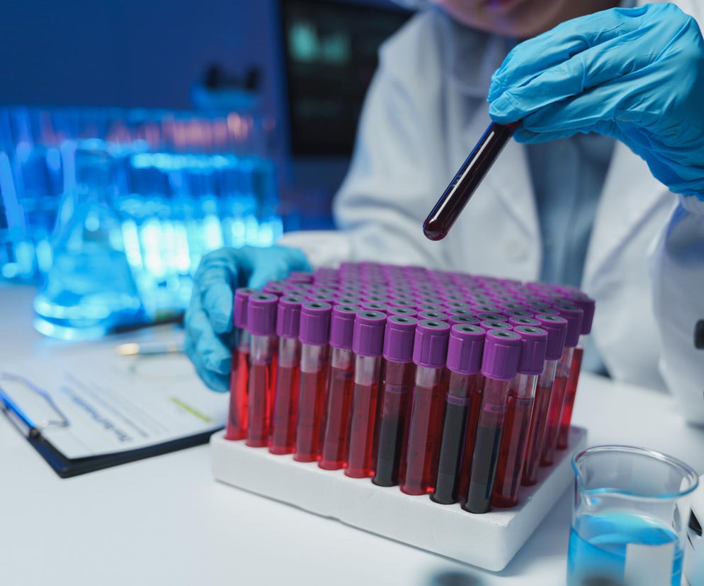 Laborant w niebieskich rękawiczkach trzyma probówkę z krwią, obok pojemnik z wieloma probówkami do badań diagnostycznych. To ważne badanie, takie jak morfologia krwi, mogą uratować życie, wczesne wykrycie chorób krwi jest kluczowe dla skutecznego leczenia, o czym przeczytasz na Poradnik Zdrowie.