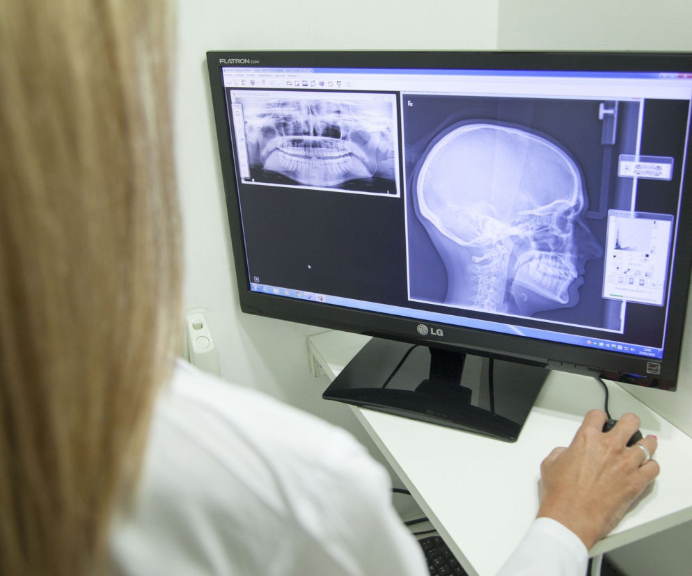 Nowy sposób diagnostyki koronawirusa stworzyła Politechnika Śląska. To internetowy system na podstawie zdjęć RTG!