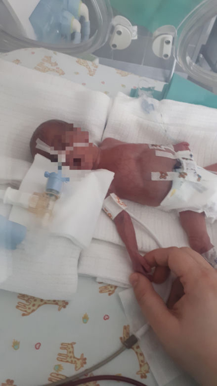 Lilianka wygrała walke o życie