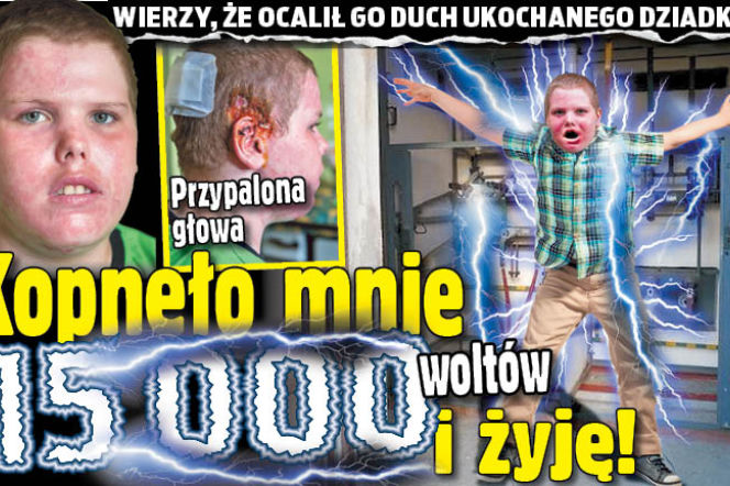Kopnęło mnie 15 000 woltów i żyję