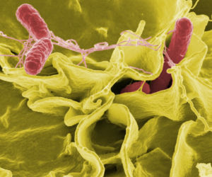 Salmonella w przedszkolu. Próbki są w laboratorium, a kiedy będą wyniki?
