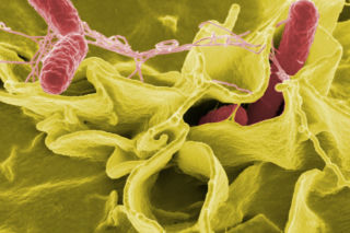 Salmonella w przedszkolu. Próbki są w laboratorium, a kiedy będą wyniki?