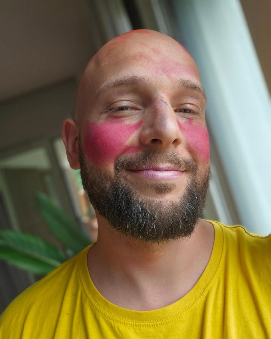 Maciej Pela miał wypadek. Wszystko opisał w sieci!