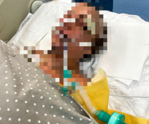 Ogolił ją na łyso, bił po głowie, upadła. Już się nie podniosła