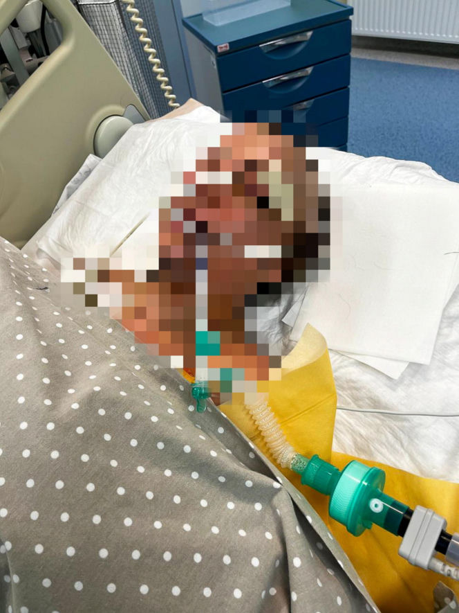 Ogolił ją na łyso, bił po głowie, upadła. Marina już się nie podniosła