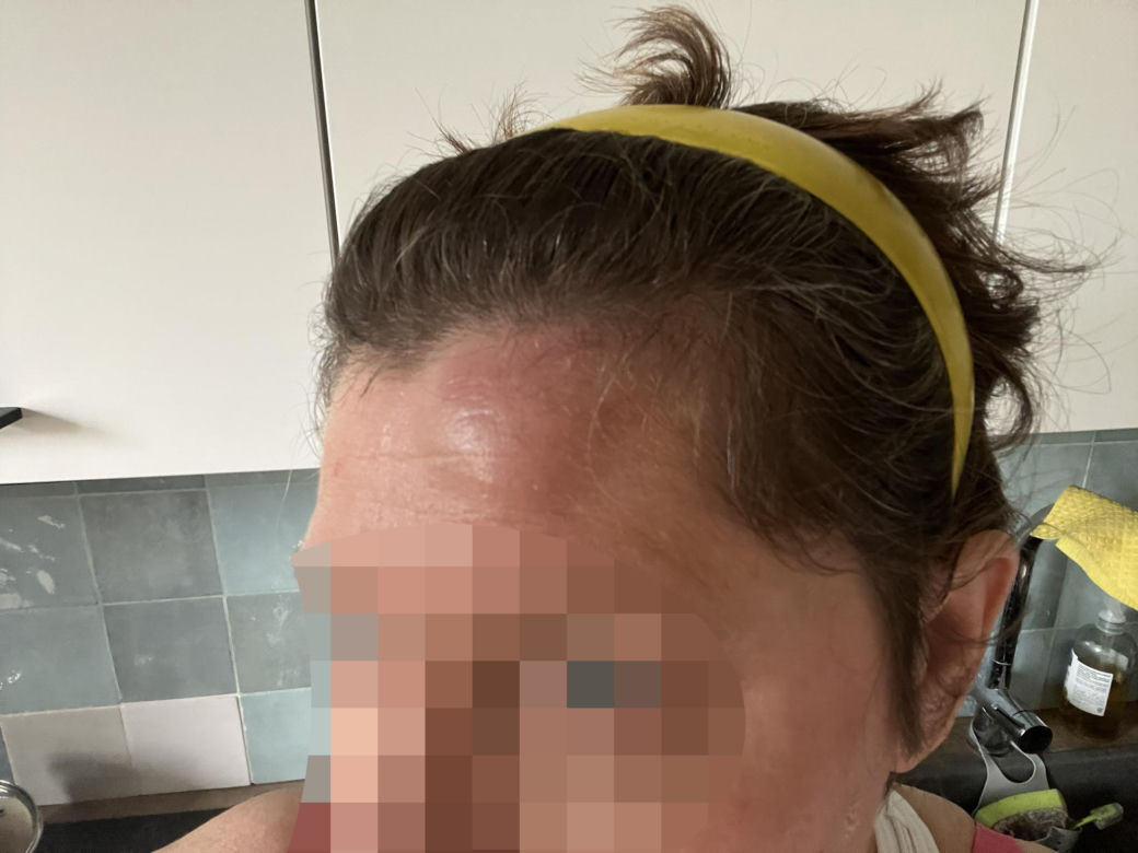 Kobieta pobita przez staruszka, bo zwróciła mu uwagę. "Przewrócił mnie na chodnik i okładał parasolką, potem uderzył pięścią w twarz"