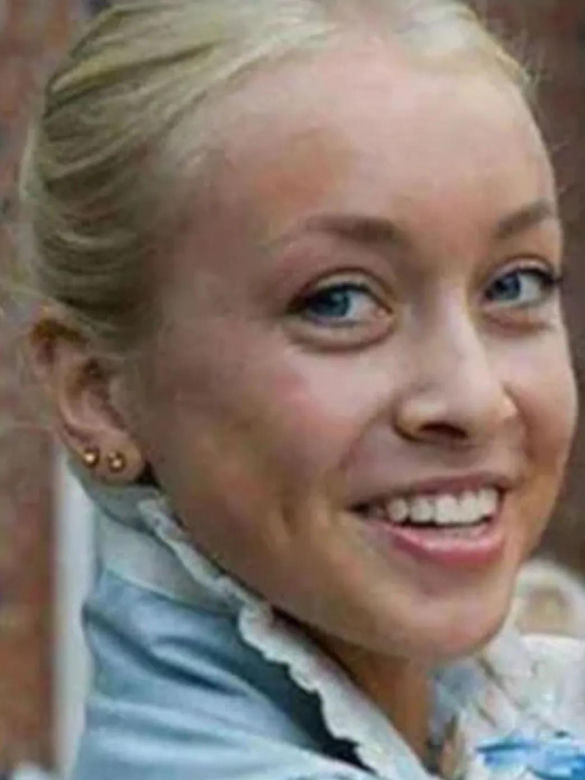 Julia Dybowska przed operacjami 
