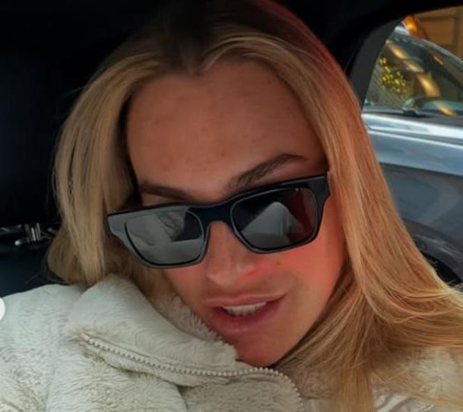 Aryna Sabalenka i jej twarz z bliska