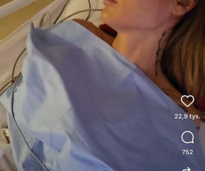 Karolina Gilon zoperowała biust. Zdjęcia przed i po