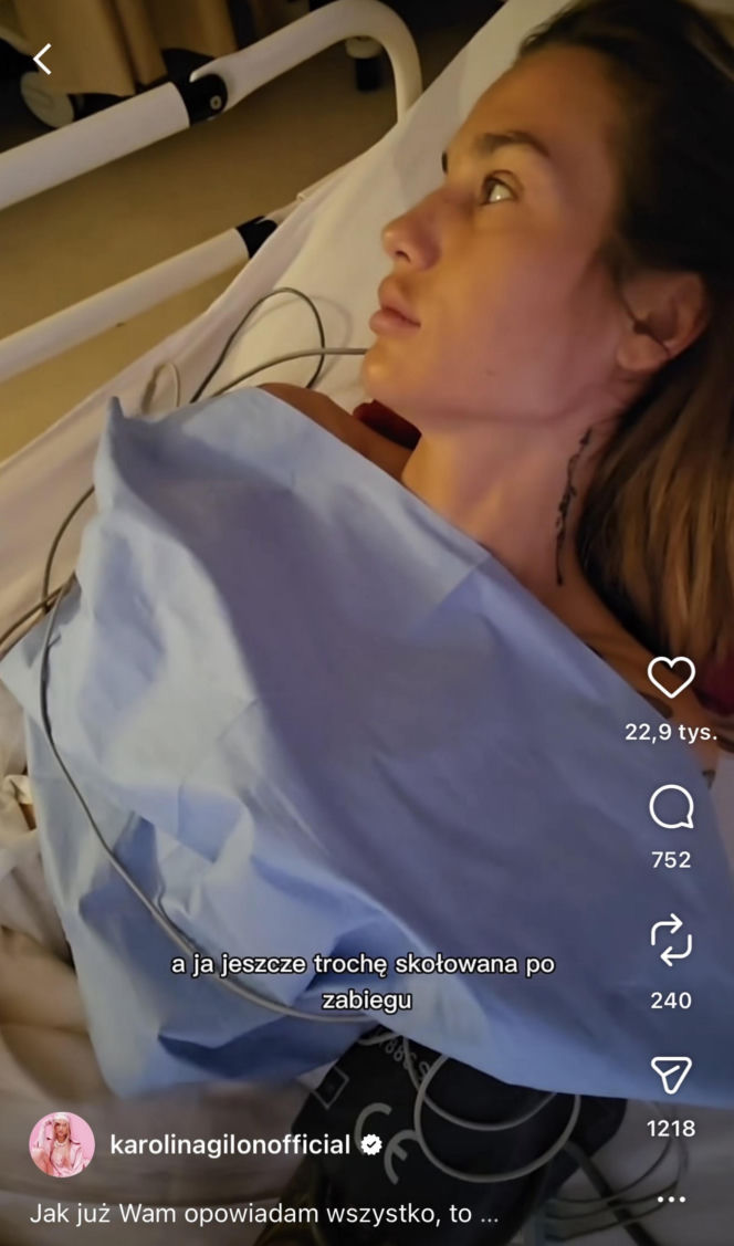 Karolina Gilon zoperowała biust. Zdjęcia przed i po