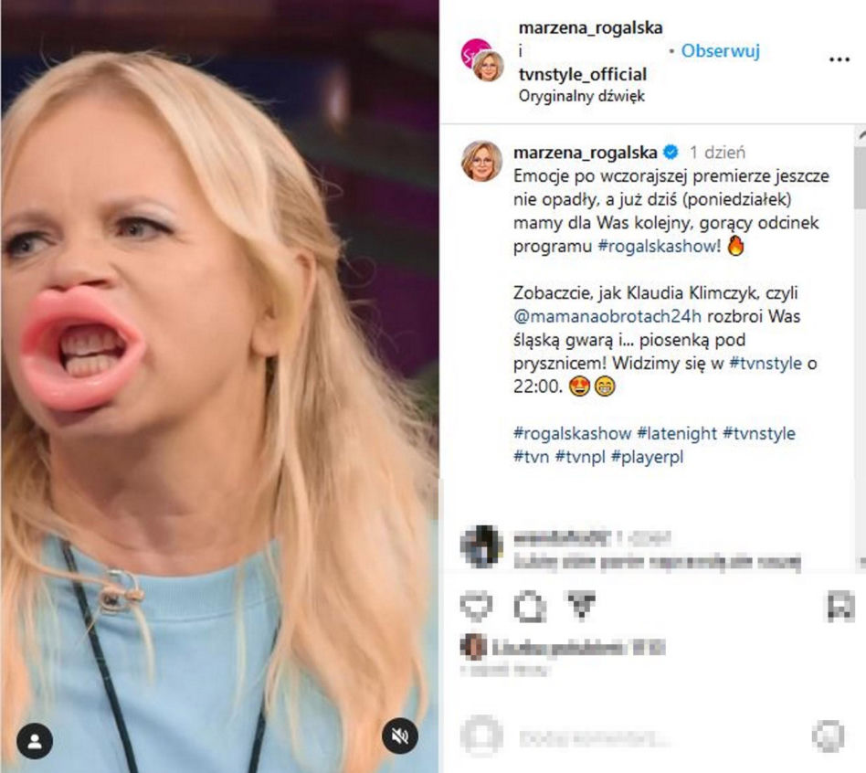 Ogromne usta Marzeny Rogalskiej! Co ona z sobą zrobiła?!