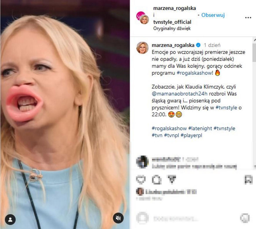 Ogromne usta Marzeny Rogalskiej! Co ona z sobą zrobiła?!