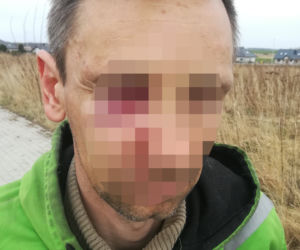 Policjanci pobili mężczyznę?