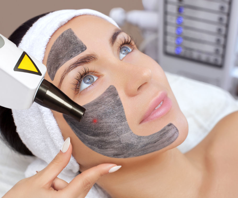 Peeling węglowy – błyskawiczny sposób na skórę pełną blasku!
