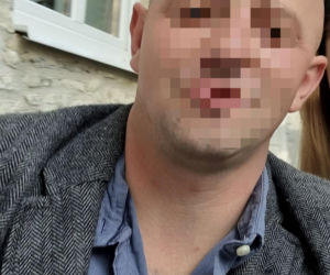 Przemysław zginął w pożarze własnego domu. 40-latek nie mógł wstać z łóżka