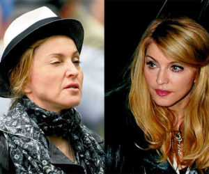 Madonna pięknieje po kwasie