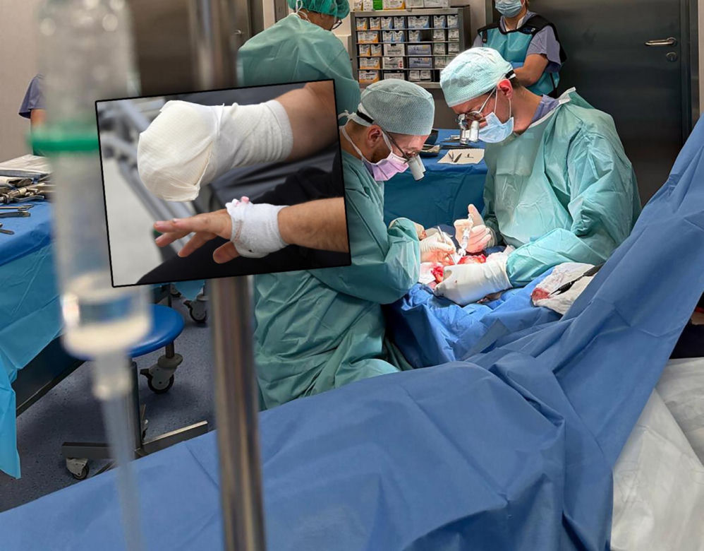 Lekarze z 5 Wojskowego Szpitala Klinicznego w Krakowie przyszyli oderwany kciuk panu Wojciechowi