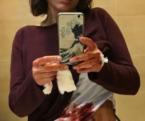 Maja Ostaszewska z prętem w brzuchu w serialu Diagnoza