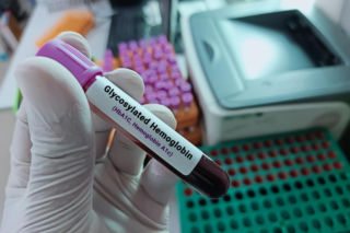 Niższy poziom hemoglobiny może działać na korzyść. Zaskakujące wnioski naukowców