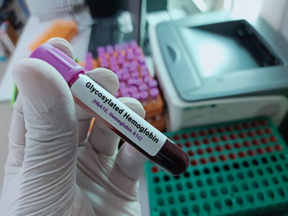 Niższy poziom hemoglobiny może działać na korzyść. Zaskakujące wnioski naukowców