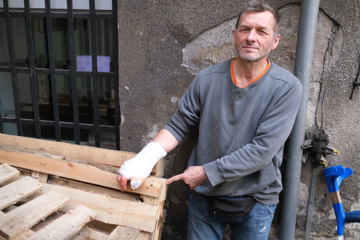 Pan Zbigniew prawie stracił rękę