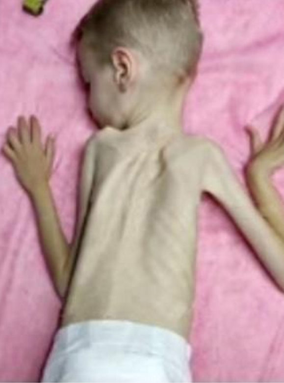  Mama przeprasza synka, że pochłonęła go choroba. 6-latek z Lublina trafił do hospicjum, ale na pomoc nie jest za późno [ZDJĘCIA]