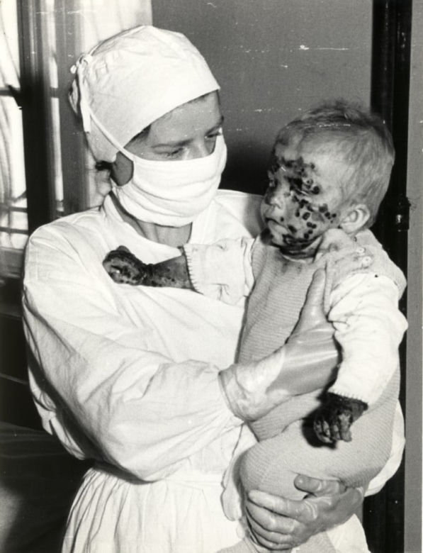 Epidemia czarnej ospy we Wrocławiu. Tak to wyglądało 60 lat temu [ZDJĘCIA] 