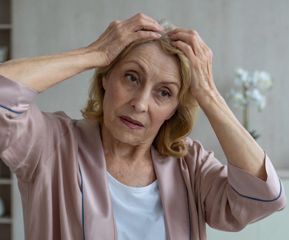 Zmagasz się z wypadaniem włosów? Te choroby mogą być przyczyną. Zobacz, kiedy działać