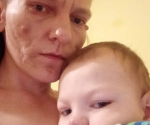 Życie pani Sylwii to droga przez mękę! Jej historia poruszyła internautów [ZDJĘCIA]