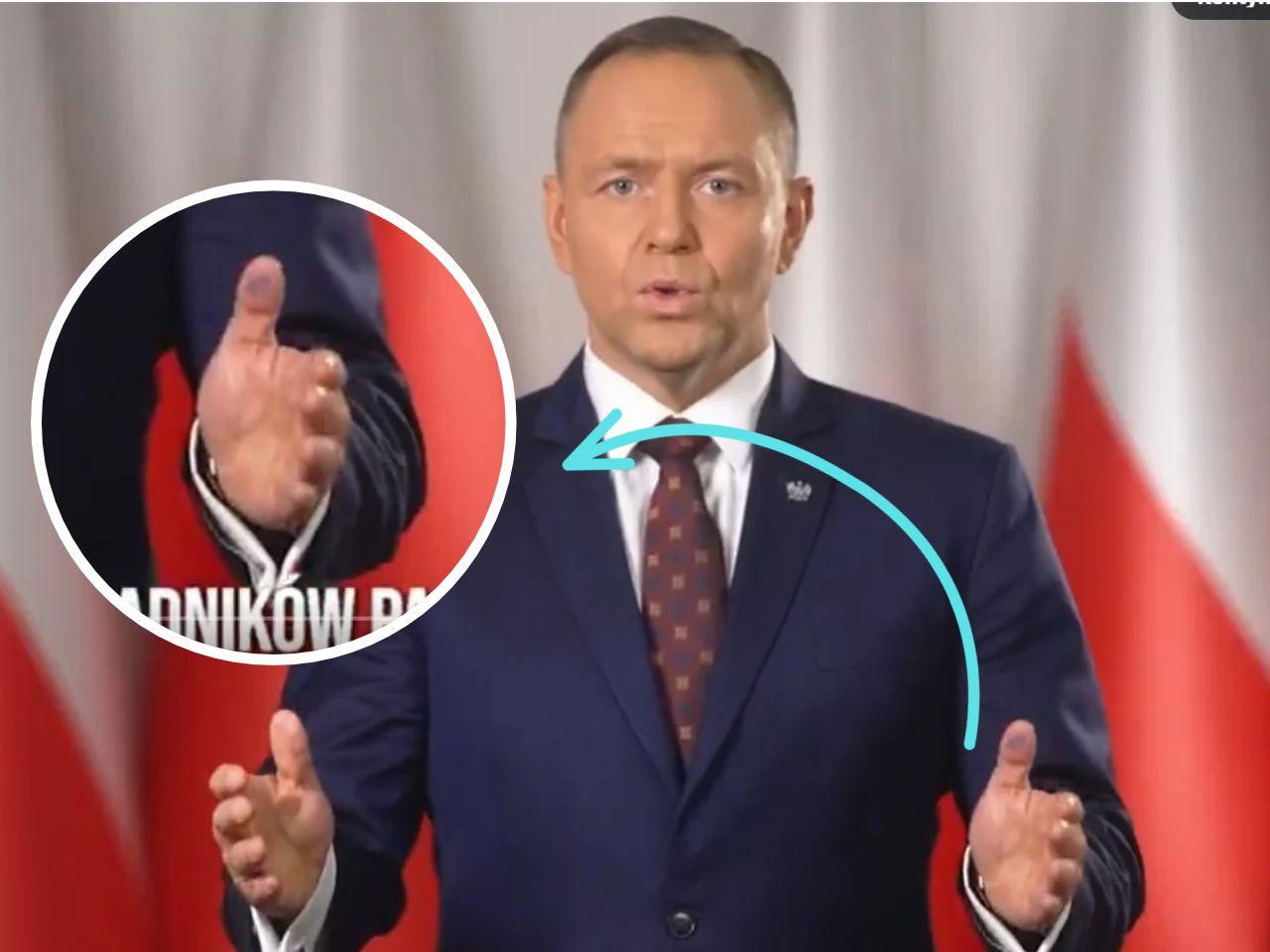 Przyjrzał się kciukowi prezydenta. Ruszyło "śledztwo". Fotograf Nawrockiego reaguje!