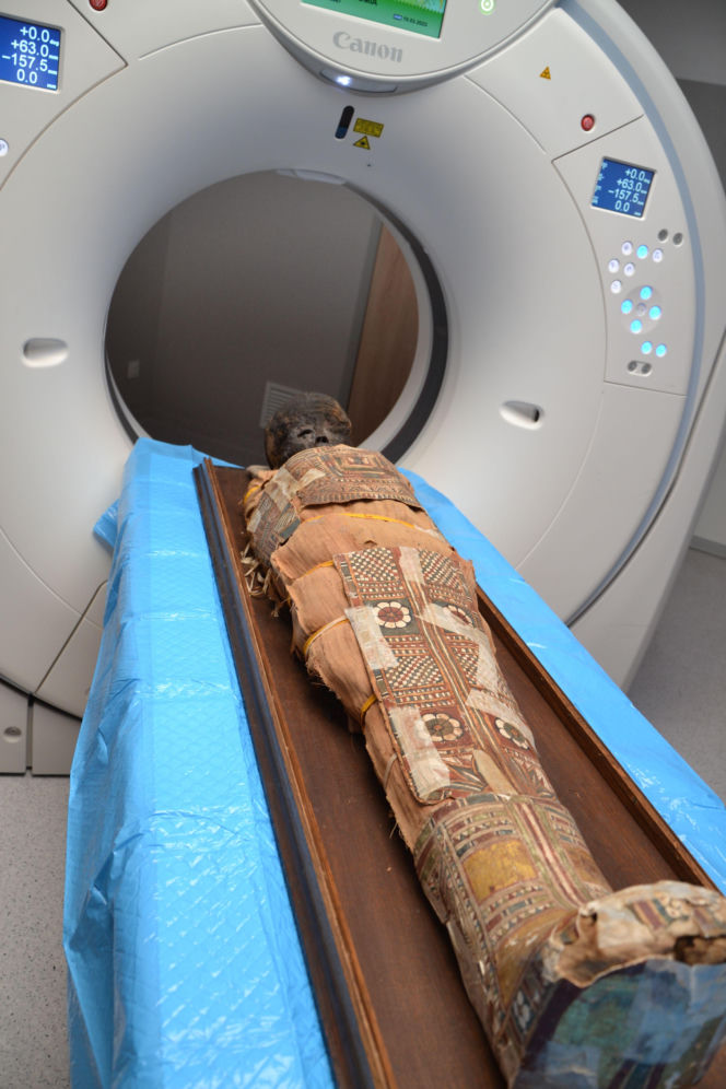 Niezwykły pacjent w szpitalu w Lublinie. To egipska mumia dziecka