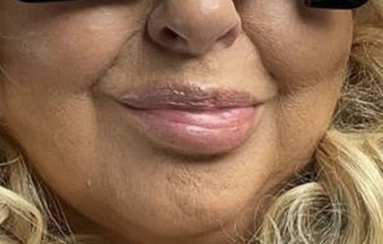 Magda Gessler. To nie botoks, to paraliż!